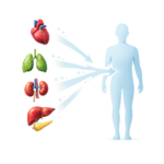 Multi Organ Transplant